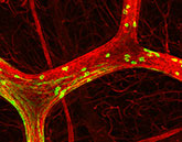 close-up of Epithelial cell fate choice in cancer and development