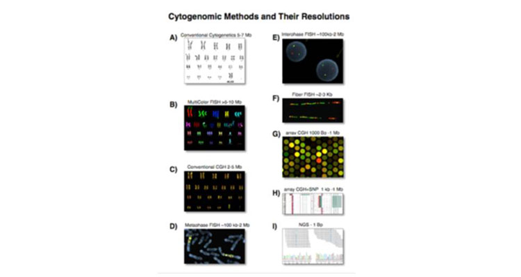 chromosome and gene testing