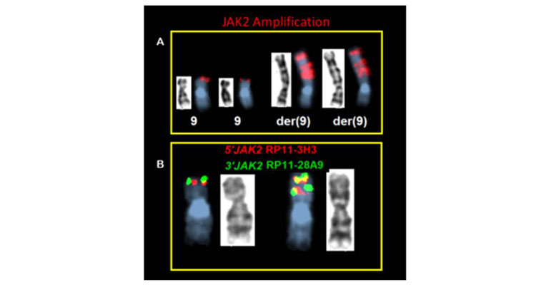 Gene amplification