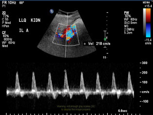 Various ultrasound images taken post-operation day