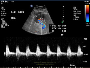 Various ultrasound images