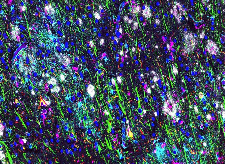 image of nerve activity via MRI