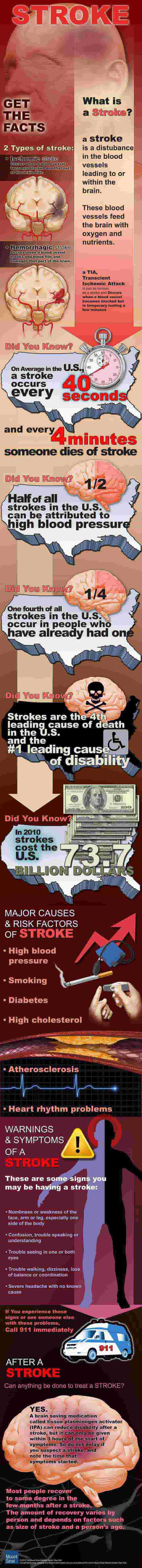 Stroke infographic