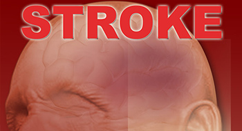 stroke infographic