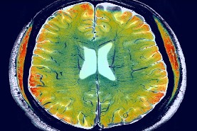 Brain scan image