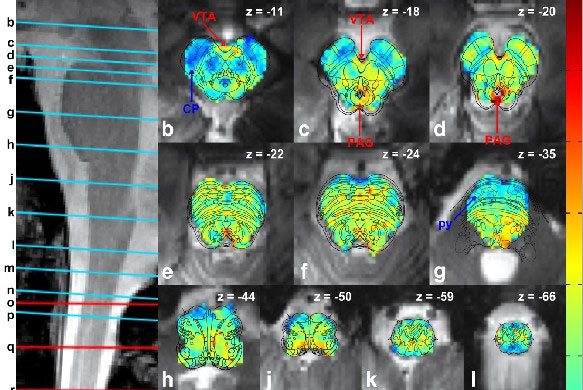 Graphic of scan images